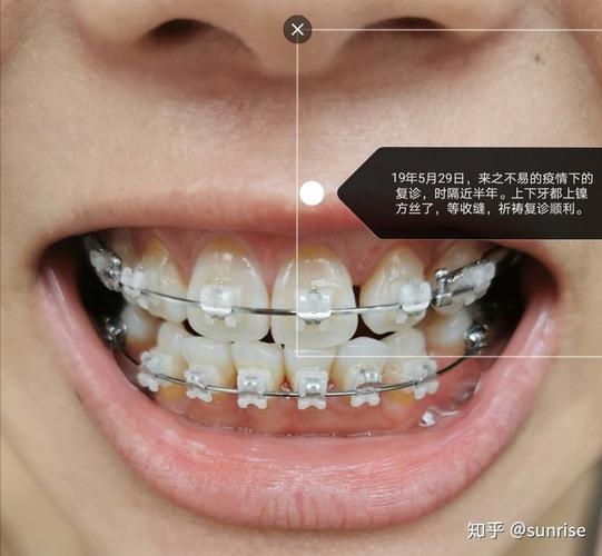 2025年北大口腔正畸-图2