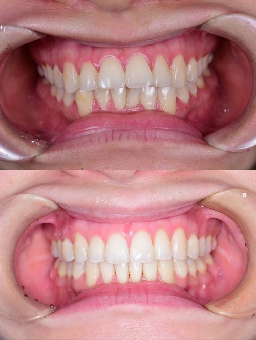 拜博口腔牙齿矫正-图3