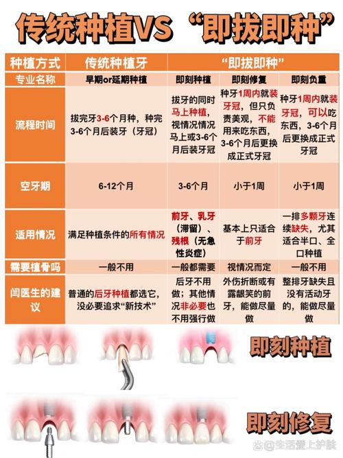 即刻种植牙与传统种牙有何区别？哪个更适合你？-图2