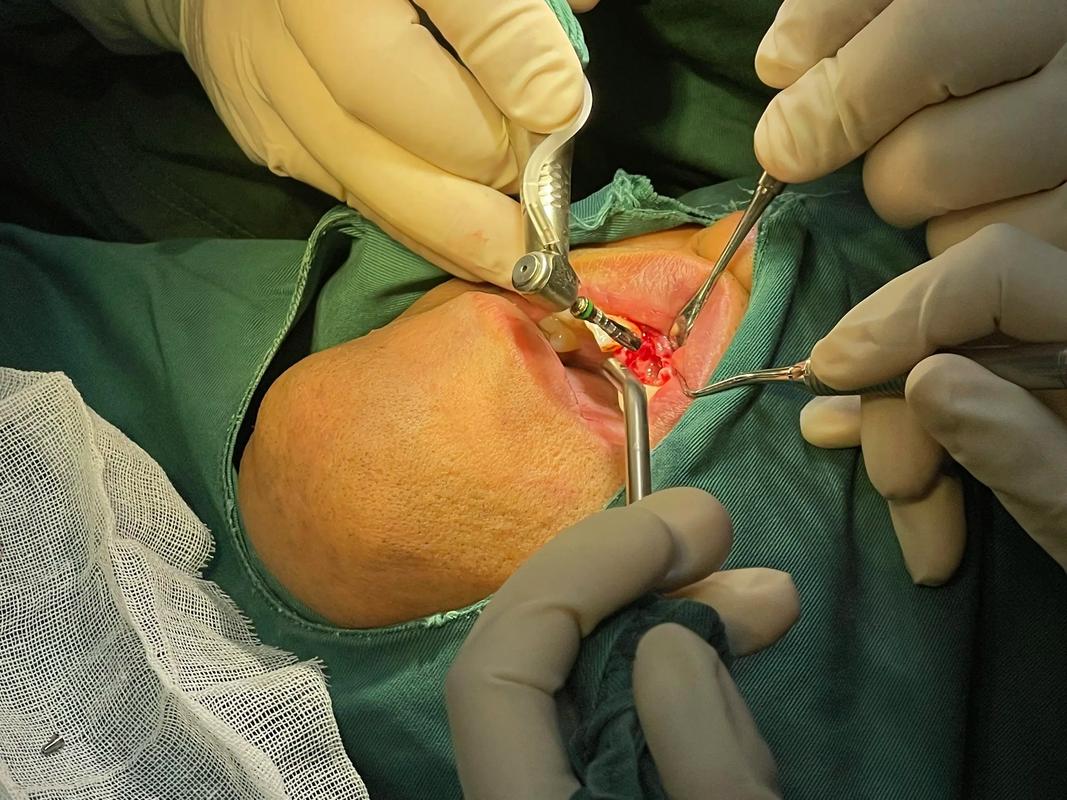 青岛 种牙 2025-图2 青岛 种牙 2025-图2