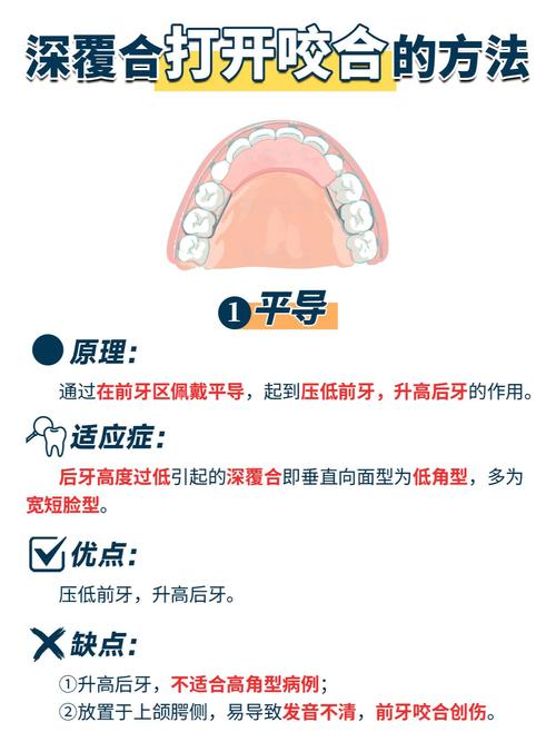 摇椅弓打开咬合的方法是什么？技术要点与临床应用-图2