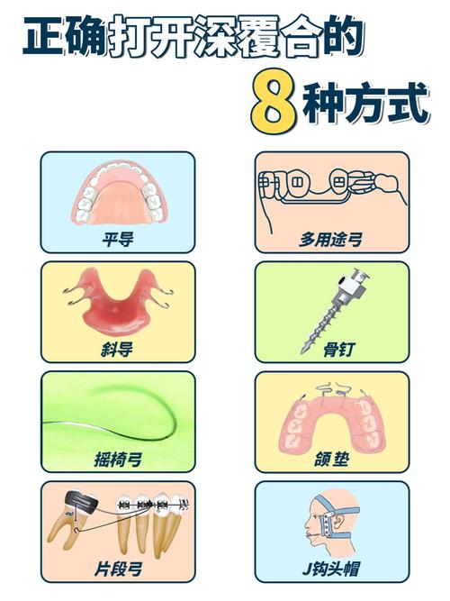 摇椅弓打开咬合的方法是什么？技术要点与临床应用-图1