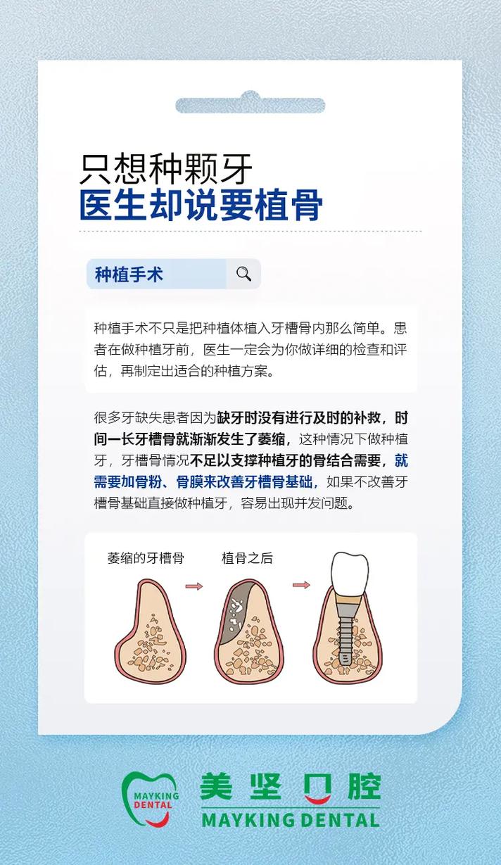 种牙什么情况下要植骨-图2 种牙什么情况下要植骨-图2