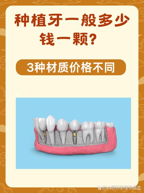 在南宁种牙多少钱一颗-图2 在南宁种牙多少钱一颗-图2