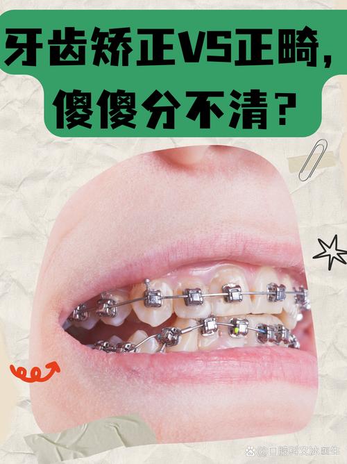 牙齿矫正几种方法的主要区别是什么？-图2