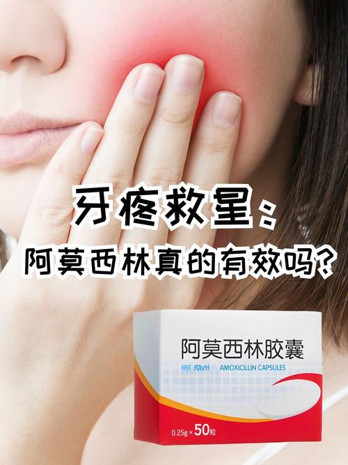 种牙后吃消炎药怎么选？有哪些注意事项？-图2