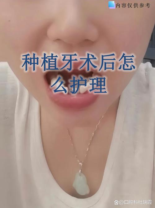 种牙第三天可以刷牙吗-图1