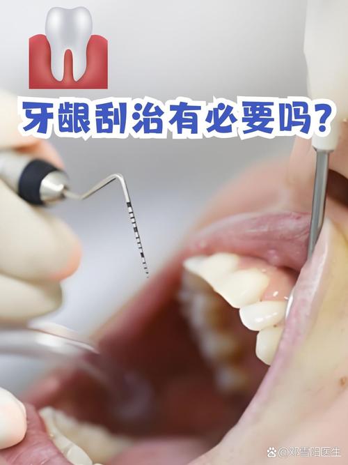 牙周炎手术有几种方法-图3