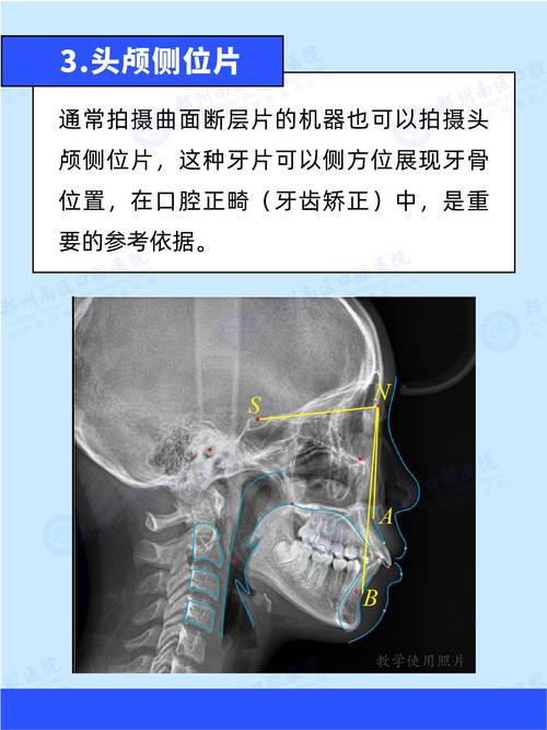 牙科X光拍摄角度怎么选？方法步骤与不同牙位应用技巧-图1