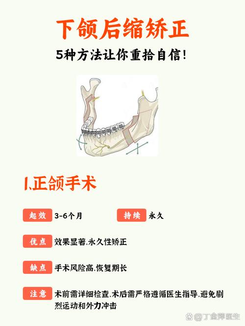 防止下颌骨变宽的方法-图1