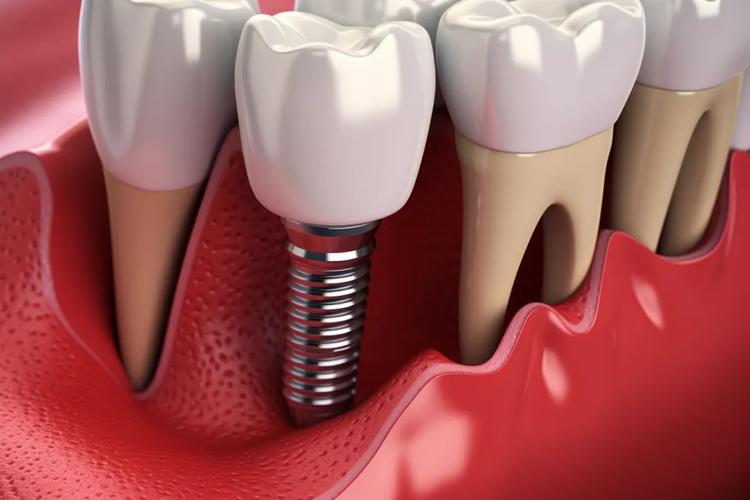 临床正畸摄影技术ppt-图1