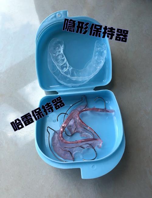 正畸保持器hawley-图2