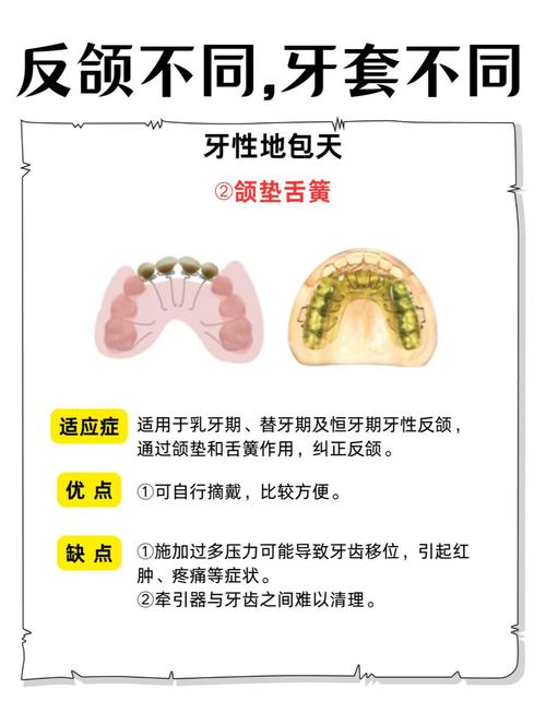 矫正地包天有那些方法-图1
