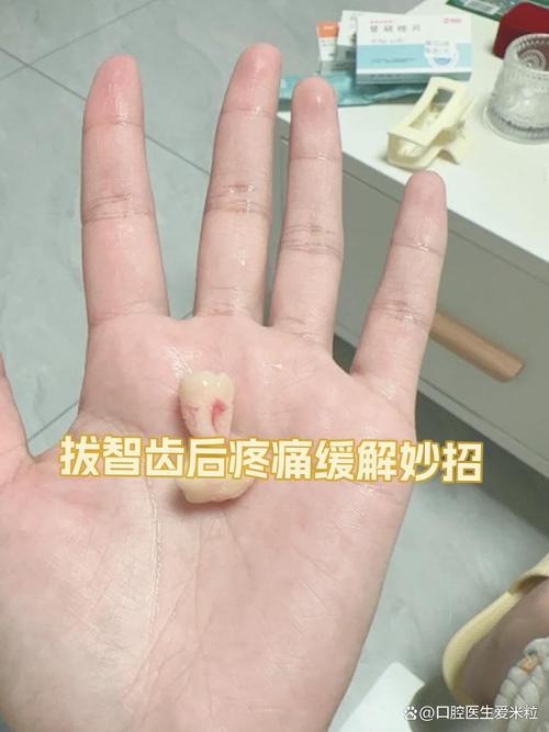 牙齿正畸 拔牙 哪个疼-图1 牙齿正畸 拔牙 哪个疼-图1