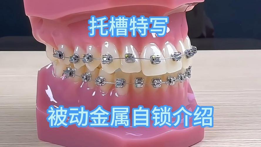 正畸金属托槽ormco-图2 正畸金属托槽ormco-图2