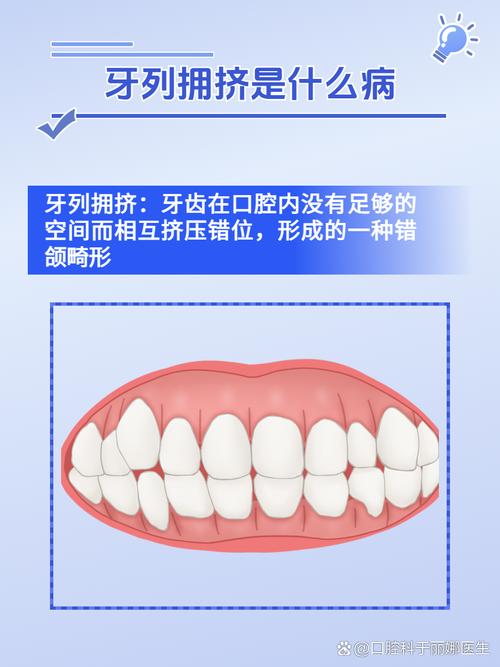 正畸牙齿拥挤程度分类有哪些依据？不同分类的正畸治疗方法有何不同？-图3