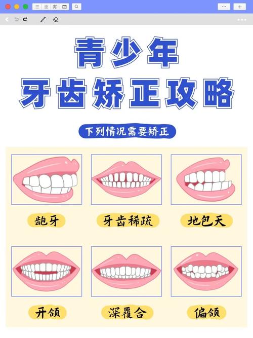 先做牙齿矫正还是种牙-图1