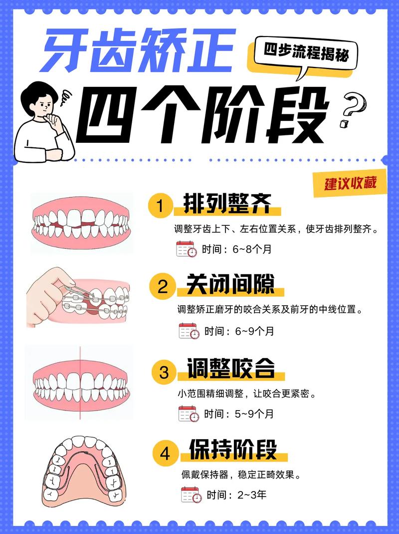先做牙齿矫正还是种牙-图3