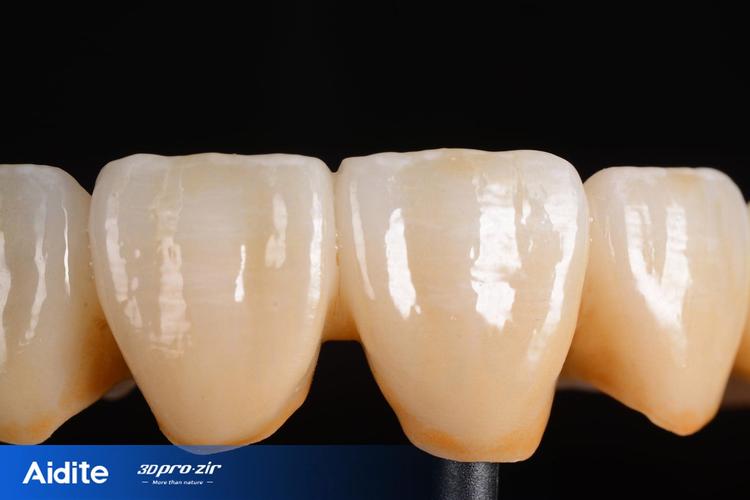 种牙后牙冠选什么材质？不同材质优缺点如何挑选合适？-图2