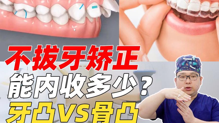 不拔牙的牙齿矫形方法-图2 不拔牙的牙齿矫形方法-图2