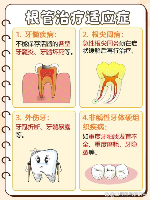龋齿发炎如何治疗方法-图2