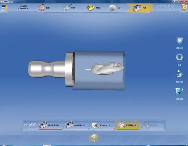cadcam 口腔正畸-图2
