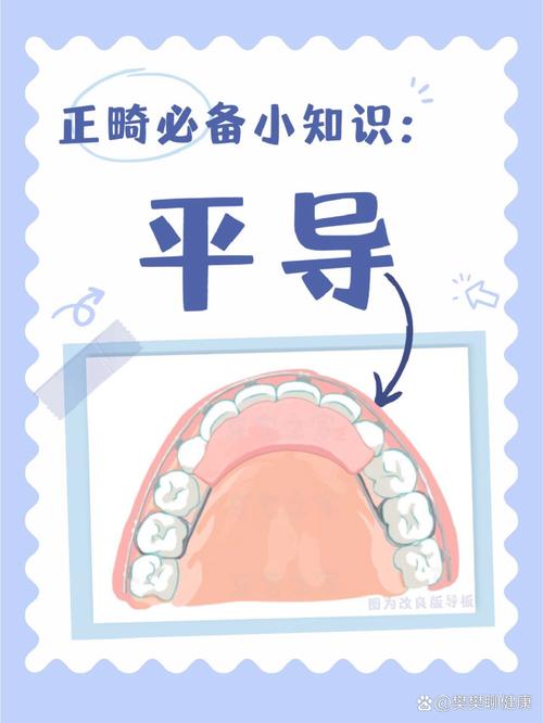 口腔正畸平导制做方法-图2