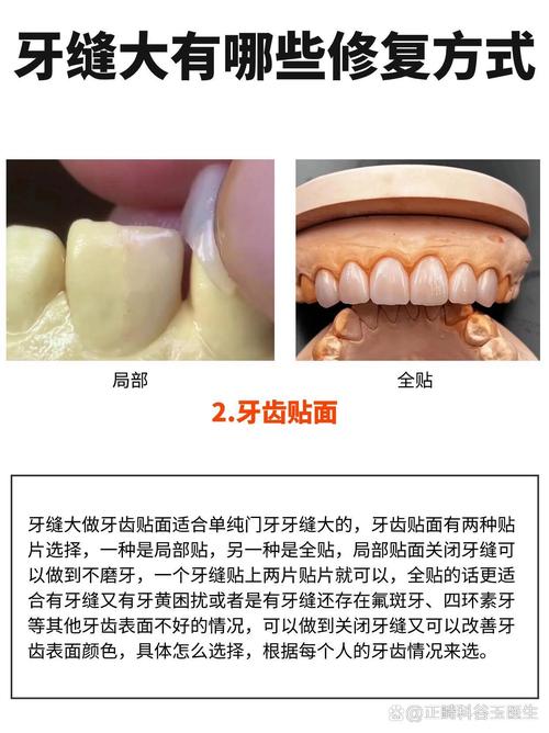 牙稀缝隙大可以种牙么-图2