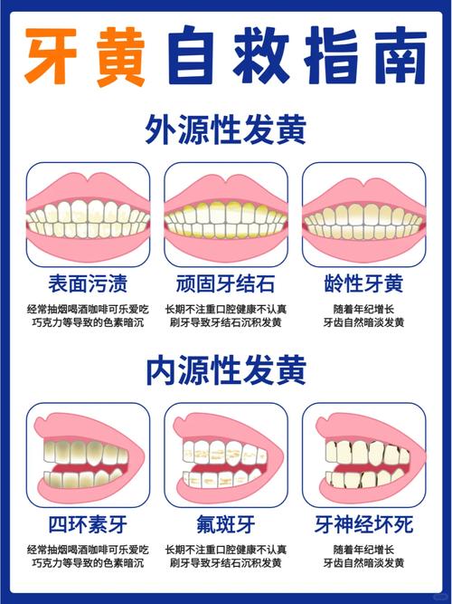 牙齿变黑变黄物理方法-图1