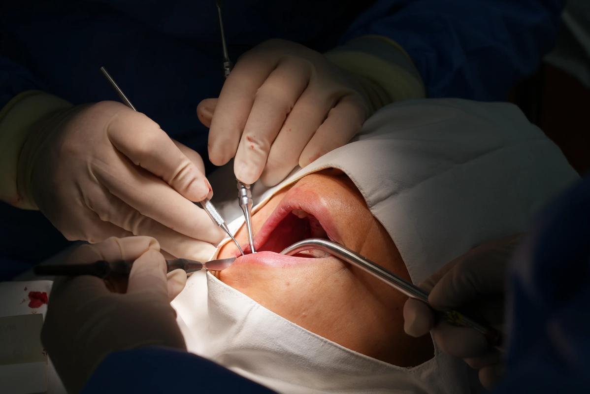 沈阳医大口腔医院种牙-图3