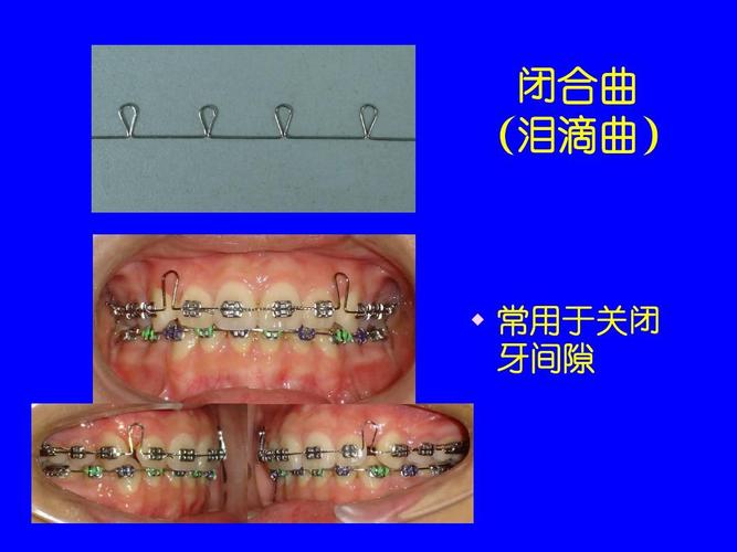 中国医科大口腔正畸学有何独特技术优势？-图1