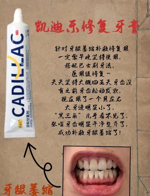 种牙会导致牙龈萎缩吗-图1