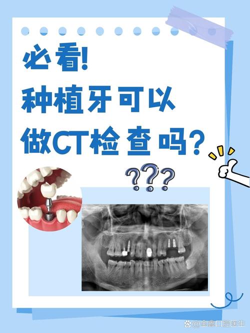 种牙CT检查的危害具体有哪些？-图1