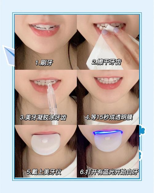 上海美白牙齿的有效方法有哪些？-图1