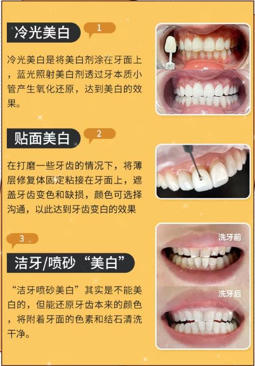 上海美白牙齿的有效方法有哪些？-图3