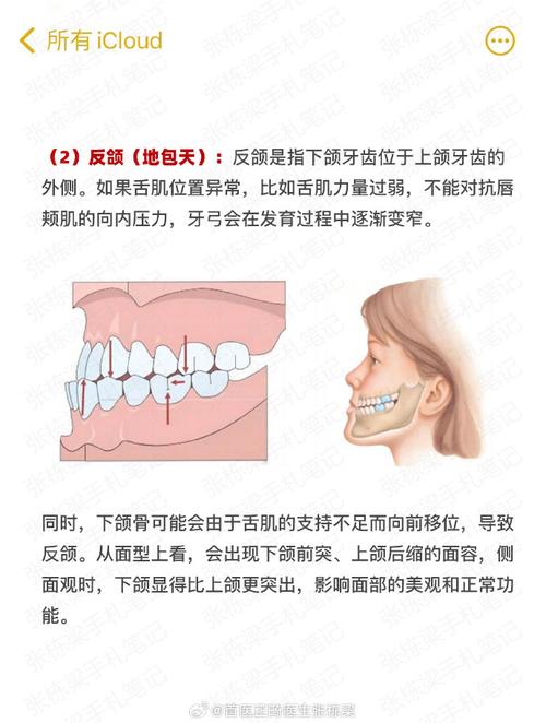 咬合侧偏一点点,正畸治疗有必要吗?-图2 咬合侧偏一点点,正畸治疗有必要吗?-图2