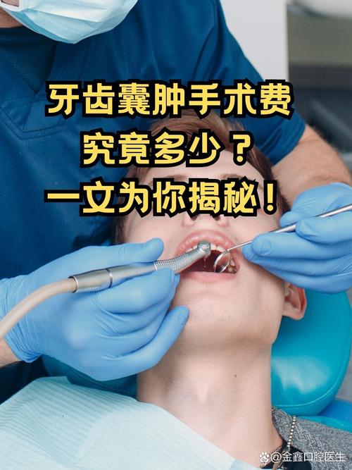 口腔囊肿如何治疗方法-图2 口腔囊肿如何治疗方法-图2