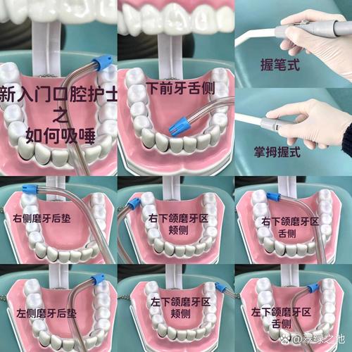 口腔黏膜内注射的方法-图3