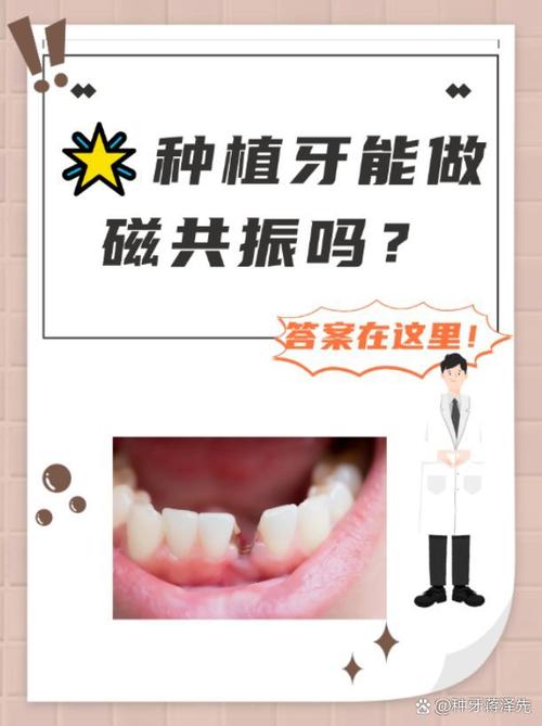 种牙会影响核磁共振检查吗？-图1