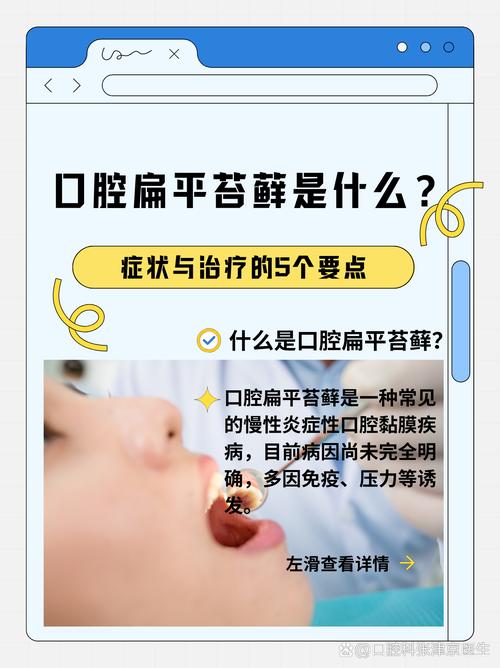 口腔遗传病有哪些有效的治疗方法？-图3