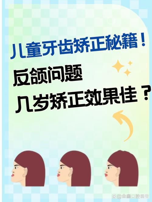 儿童严重反颌矫治方法有哪些？如何科学选择以确保效果？-图1