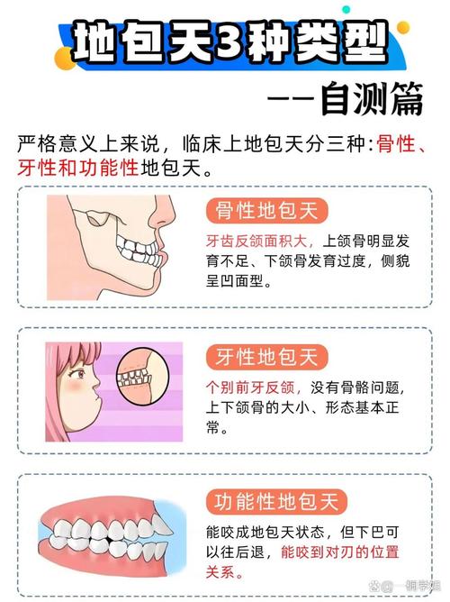 儿童严重反颌矫治方法有哪些？如何科学选择以确保效果？-图2