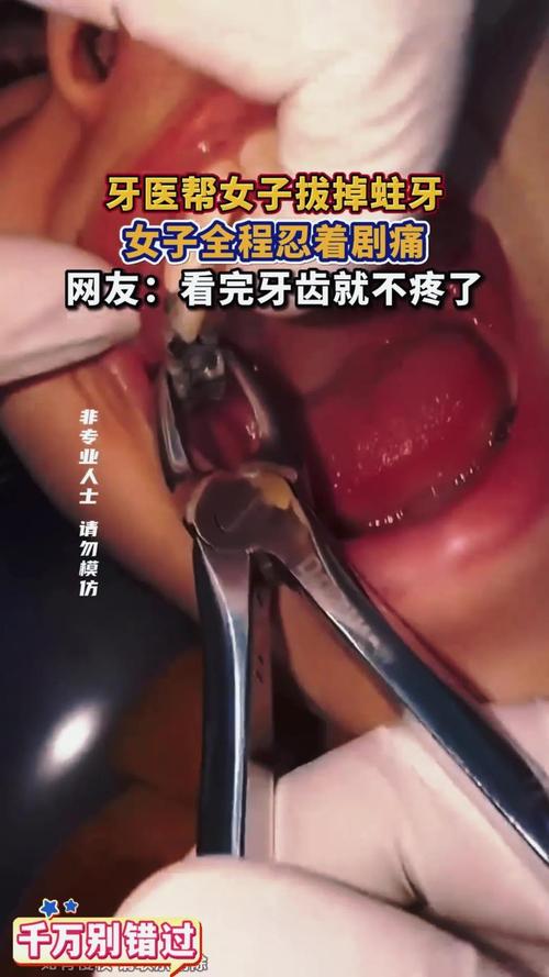 蛀牙拔了一定要种牙吗-图2