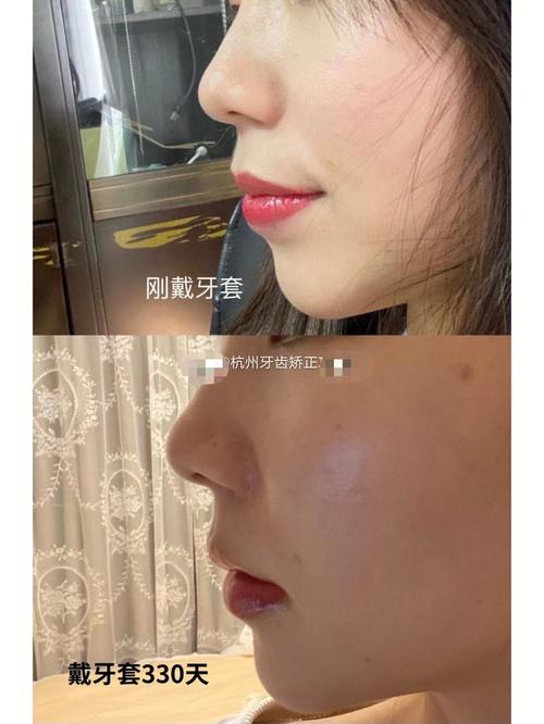 天津市正畸进修生招聘，报名条件与流程是什么？-图2