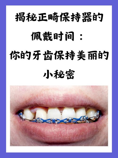 正畸要一直戴保持器么-图1