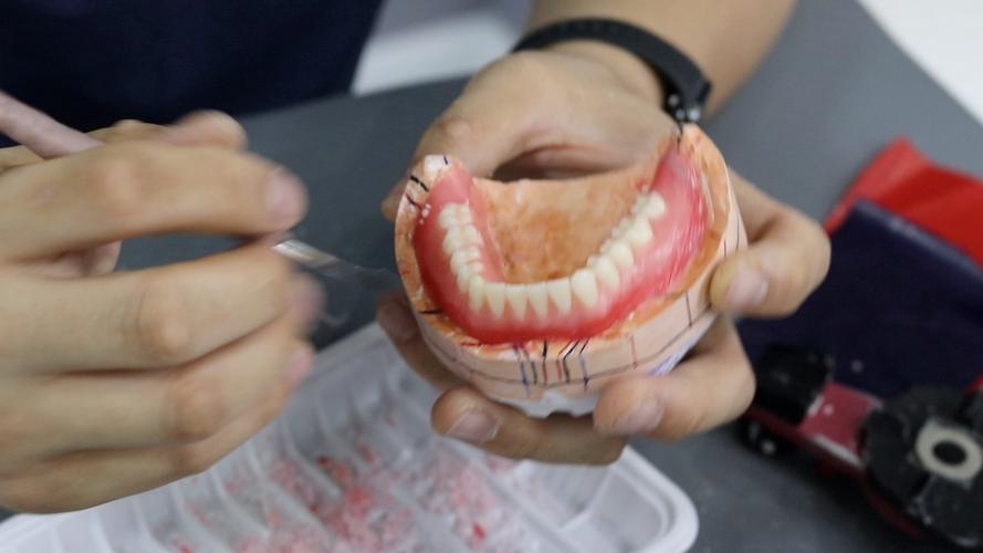 全口义齿装盒方法优点-图1