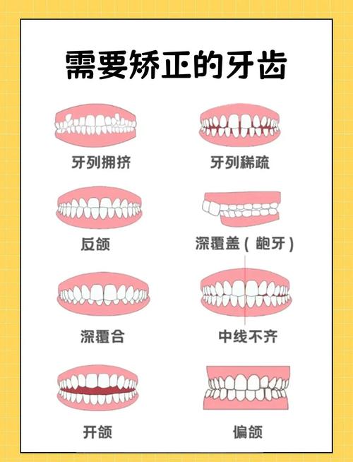 矫正牙齿哪种方法能真正做到不痛？-图2