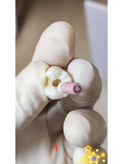 牙科修复自凝树脂的方法是什么？操作要点和注意事项有哪些？-图2