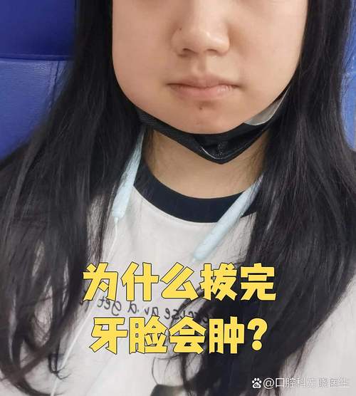 牙龈手术后脸部肿了怎么消？快速消肿方法有哪些？-图1