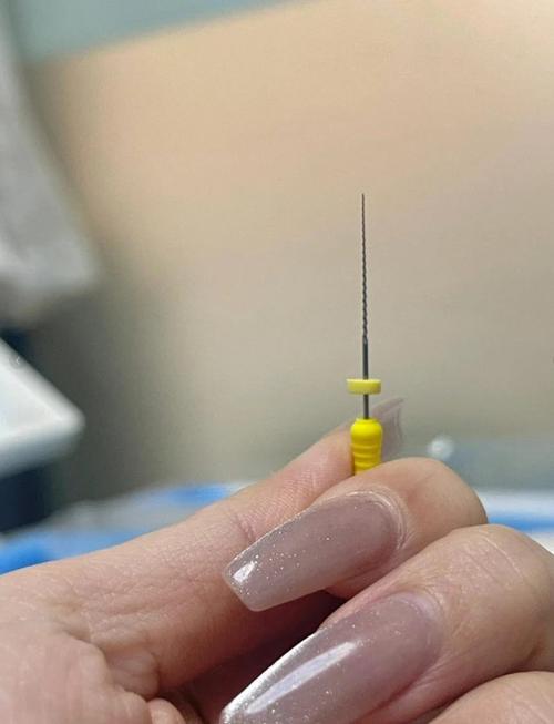 拔髓针的正确方法视频-图2